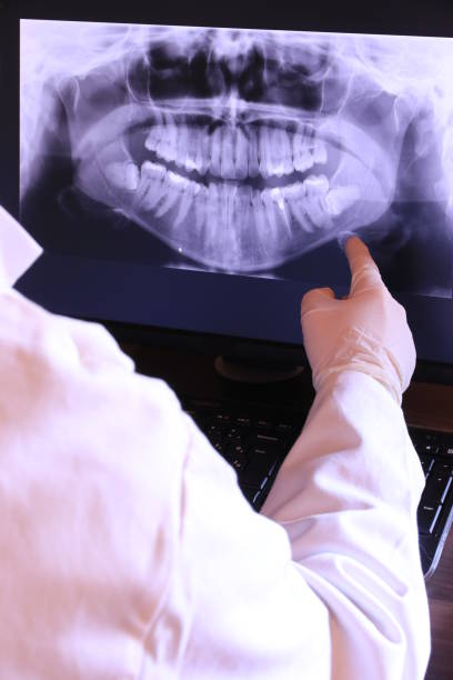 Best Emergency Dentist for Lost Fillings or Crowns in Wayne, MI
